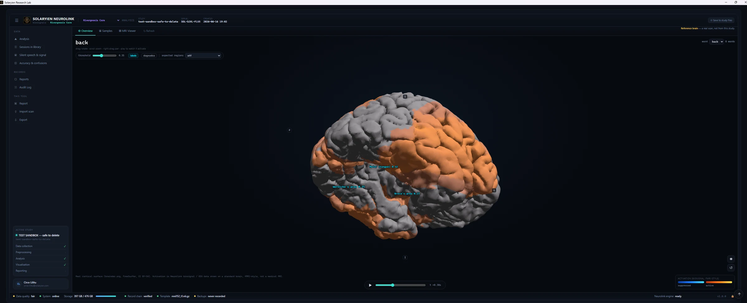 Solaryien Neurolink 1